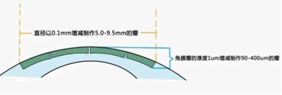 近视眼手术安全吗 专家谈个性化安全治近视的重要性