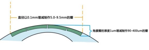 安全治近视，飞秒激光个性化的关键在哪里?