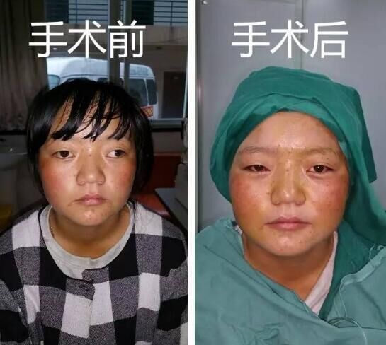 8名西藏眼病儿童完成返藏